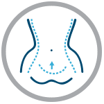 ventre - abdomen : chirurgie et liposuccion